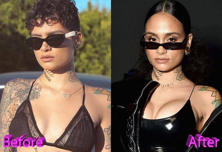 becky enders recommends kehlani tits pic