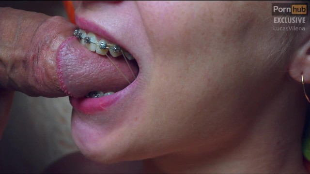 anne marie wirth recommends braces blow job pic