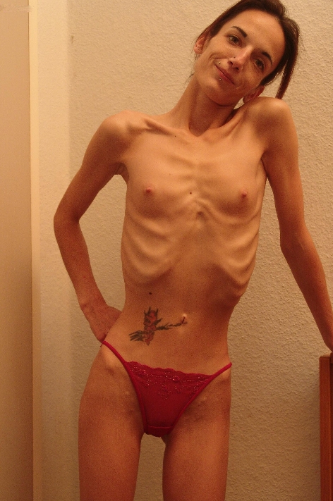 diana constable recommends nude anorexic women pic