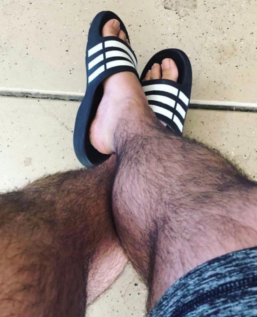 ally gibney share porn hairy legs photos